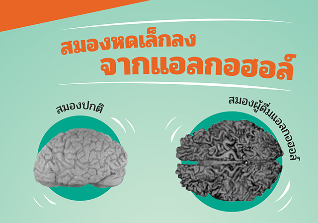 ดื่มแอลกอฮอล์ สมองหด อัลไซเมอร์